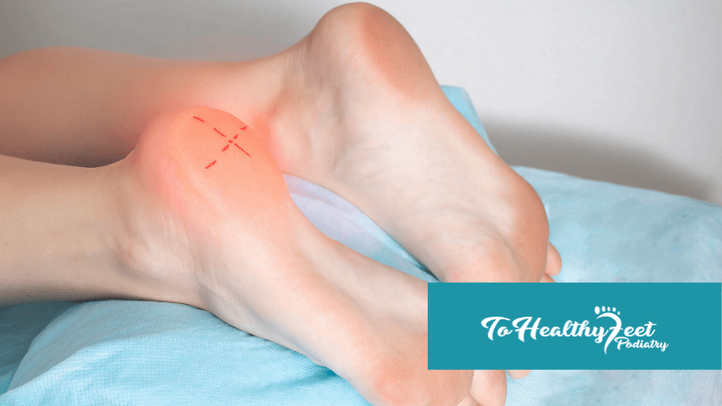 Recovery Without Surgery: Is Tenex An Option For You?